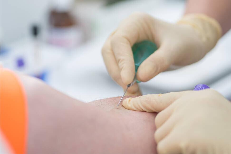 尿蛋白高导致的肾病有什么危害,尿蛋白高有尿毒症的危险吗