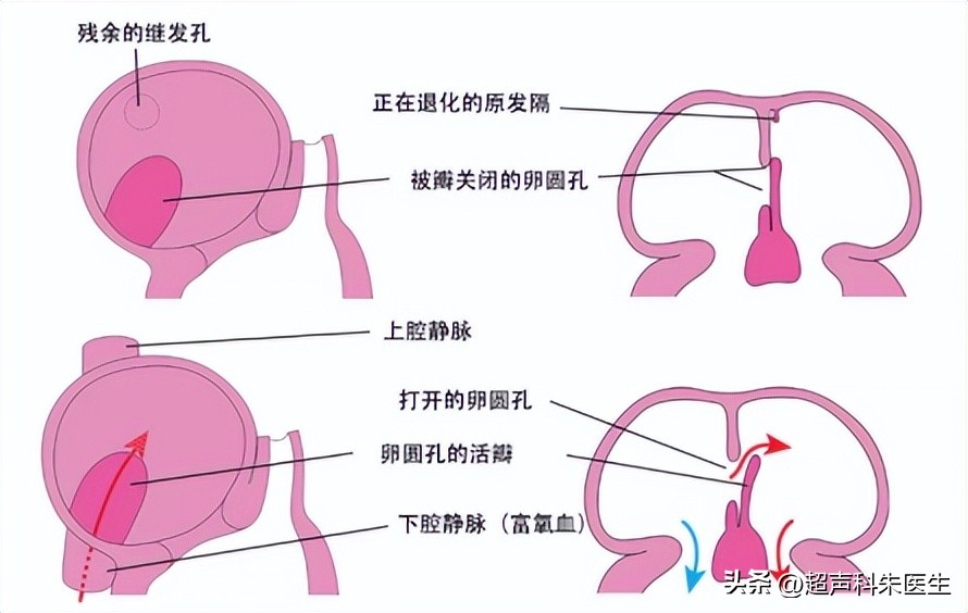 心眼多和心计是好事还是坏事,心眼多心不正