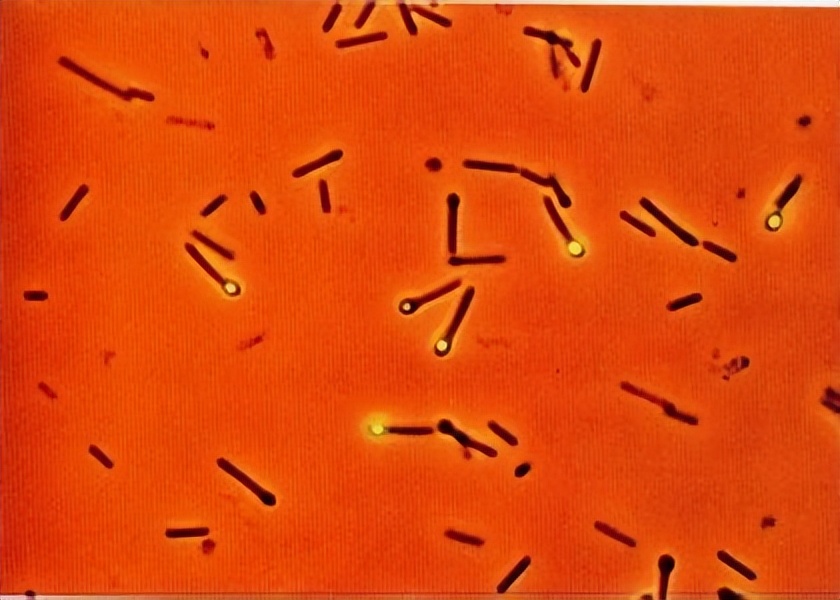 革兰氏阳性孢子,革兰氏阳性孢子菌