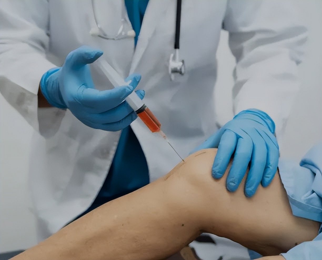 腰疼打封闭针对腰有影响吗,肘关节打封闭针有什么影响