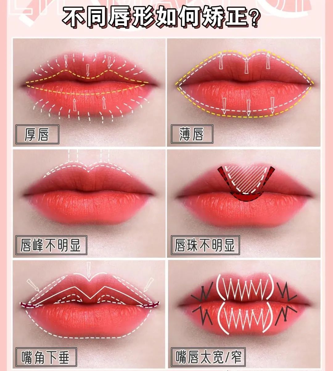 唇形改善案例,唇形变美干货