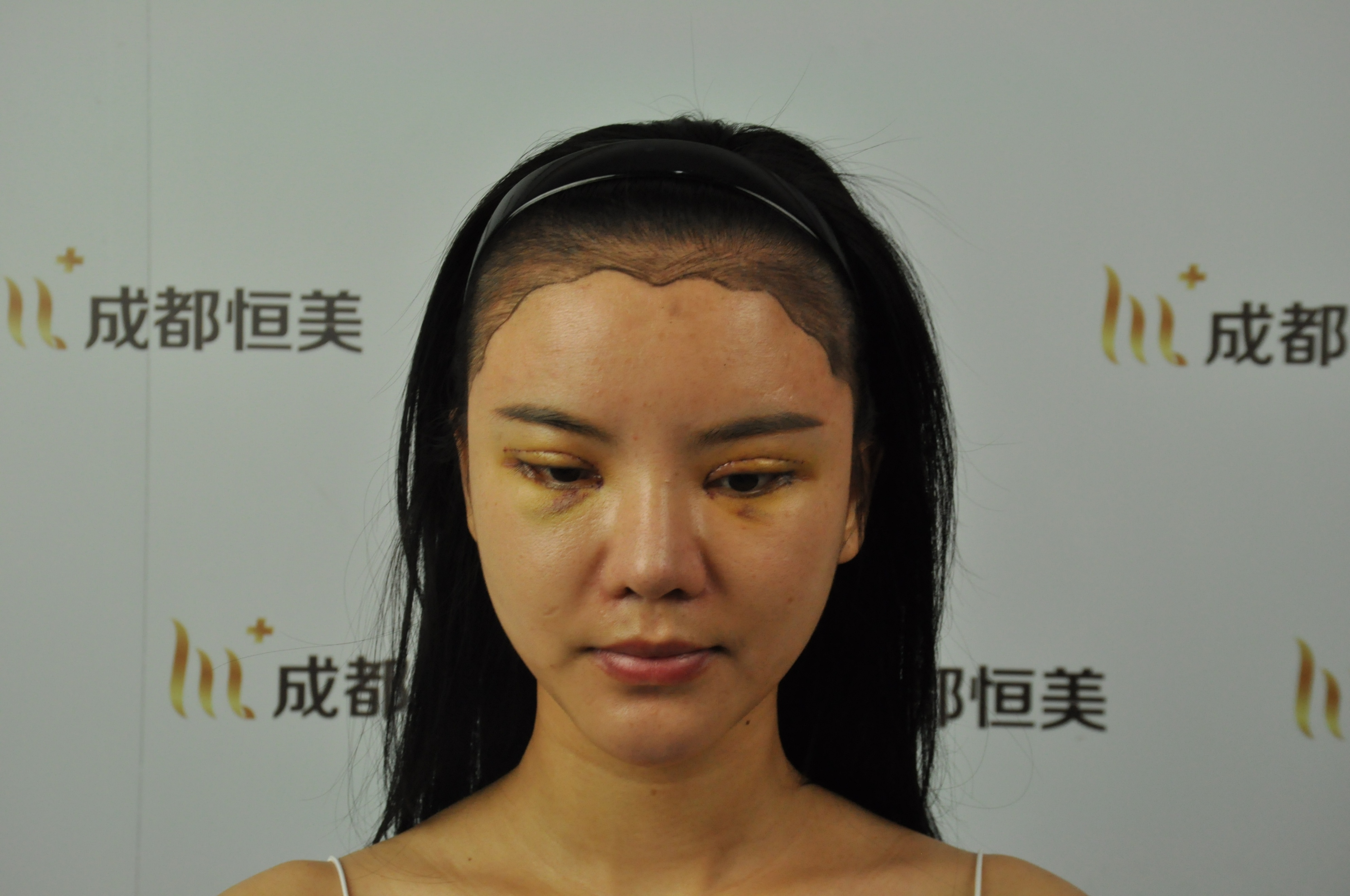 恒美植,成都恒美植