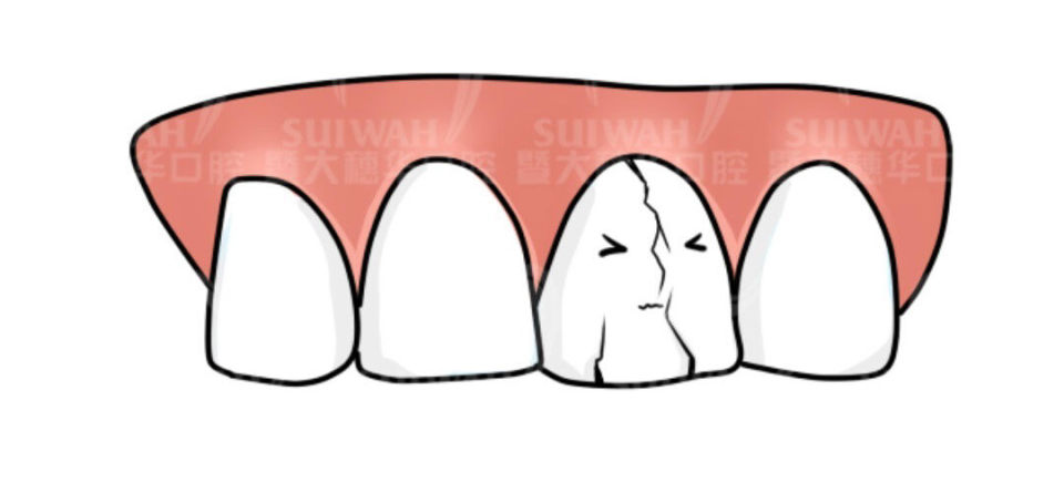 明明没有蛀牙为什么牙齿还会痛,儿童牙齿蛀牙疼痛快速解决办法