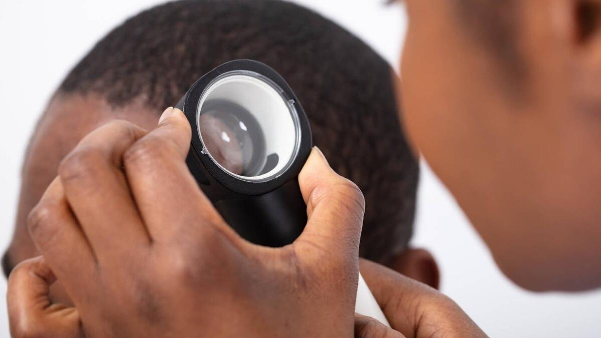 头皮上长痘痘是什么原因怎么处理,头皮突然长脓包痘怎么治