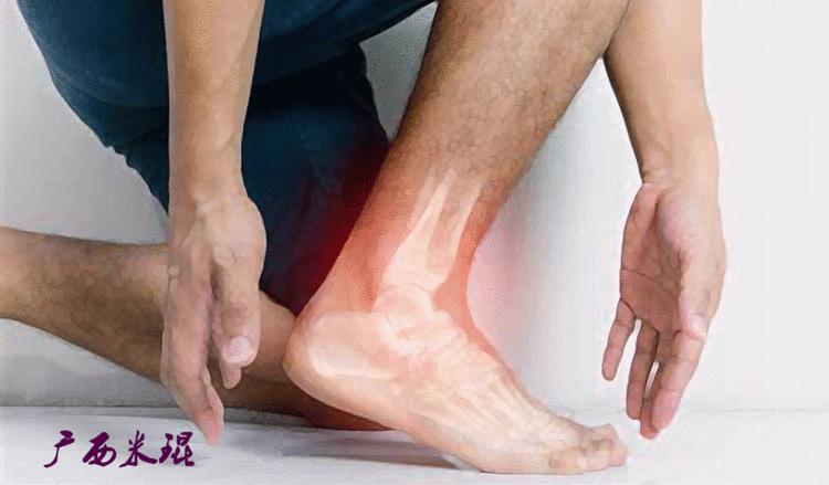 距骨软骨损伤最好的治疗方法,距骨软骨损伤的诊断