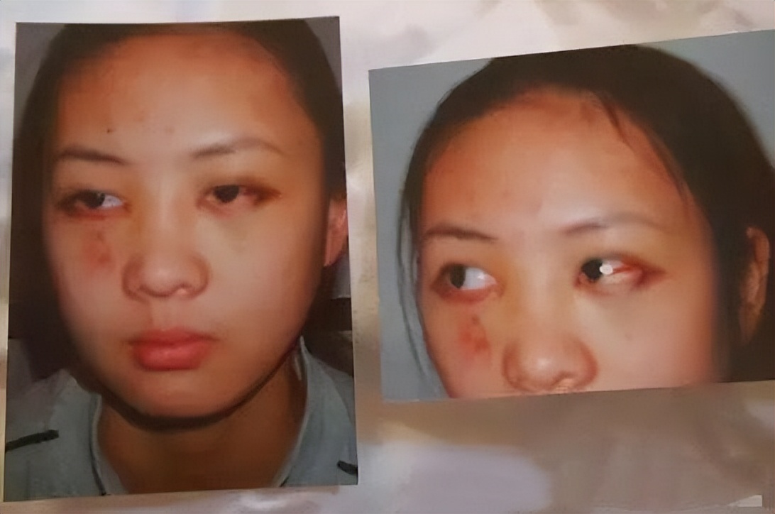 童瑶被张默打后如何翻身,童瑶哪一年被张默打的