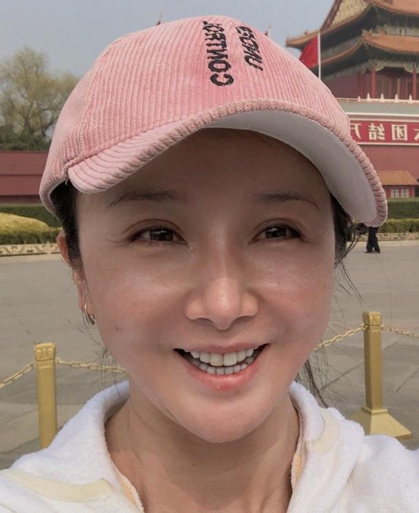 明星下颚骨整容后遗症,脸像鞋拔子怎么改善