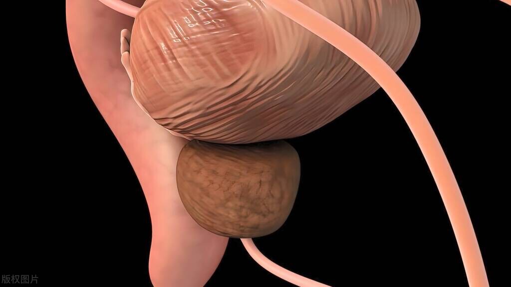 尿道管畸形必须做手术吗,男性尿道畸形矫正