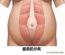 关爱产后妈妈｜帮您了解产后康复