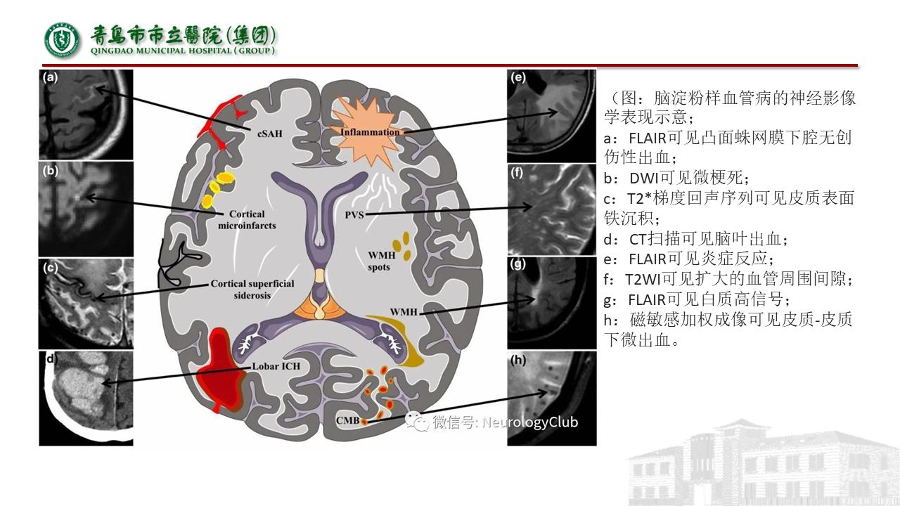 神经内科疾病临床诊疗思维,神经内科理论知识总结
