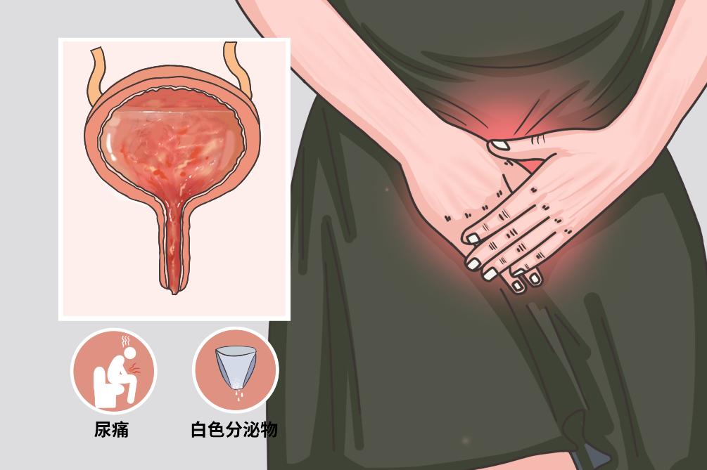 尿频尿急请及时就医,从小就尿频尿急二十多年了正常吗