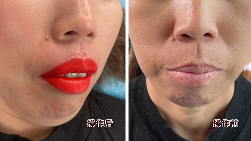 诺娇智造工厂梦露纹唇双针机：不用提高技术能力，做出上色快唇部