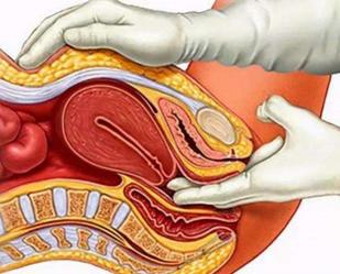 妇科检查366元检查项目,妇科ctc检查和hpv检查有什么区别