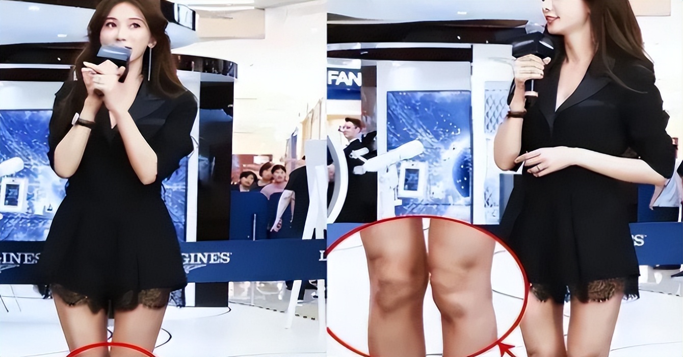 林志玲被家暴到假体掉落是真的吗,林志玲被家暴到假体掉落