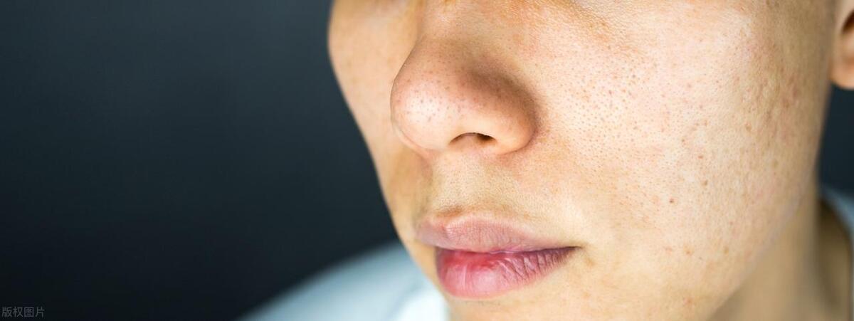 男士怎么选择护肤品才正确,男士混合肌肤护肤品推荐