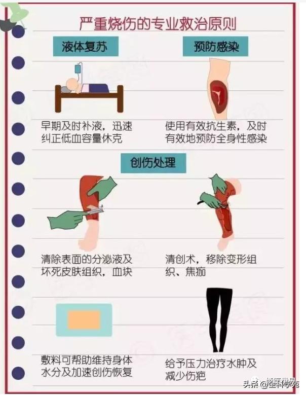 烧伤烫伤防护与急救知识英文,烧伤冻伤如何处理