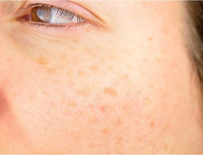 肝寒痛多脾寒多,肝寒怎样调理