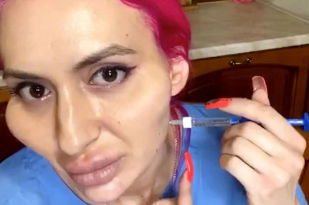 这个动手术打造世界最高颧骨的女人，再次向自己的颧骨下手了