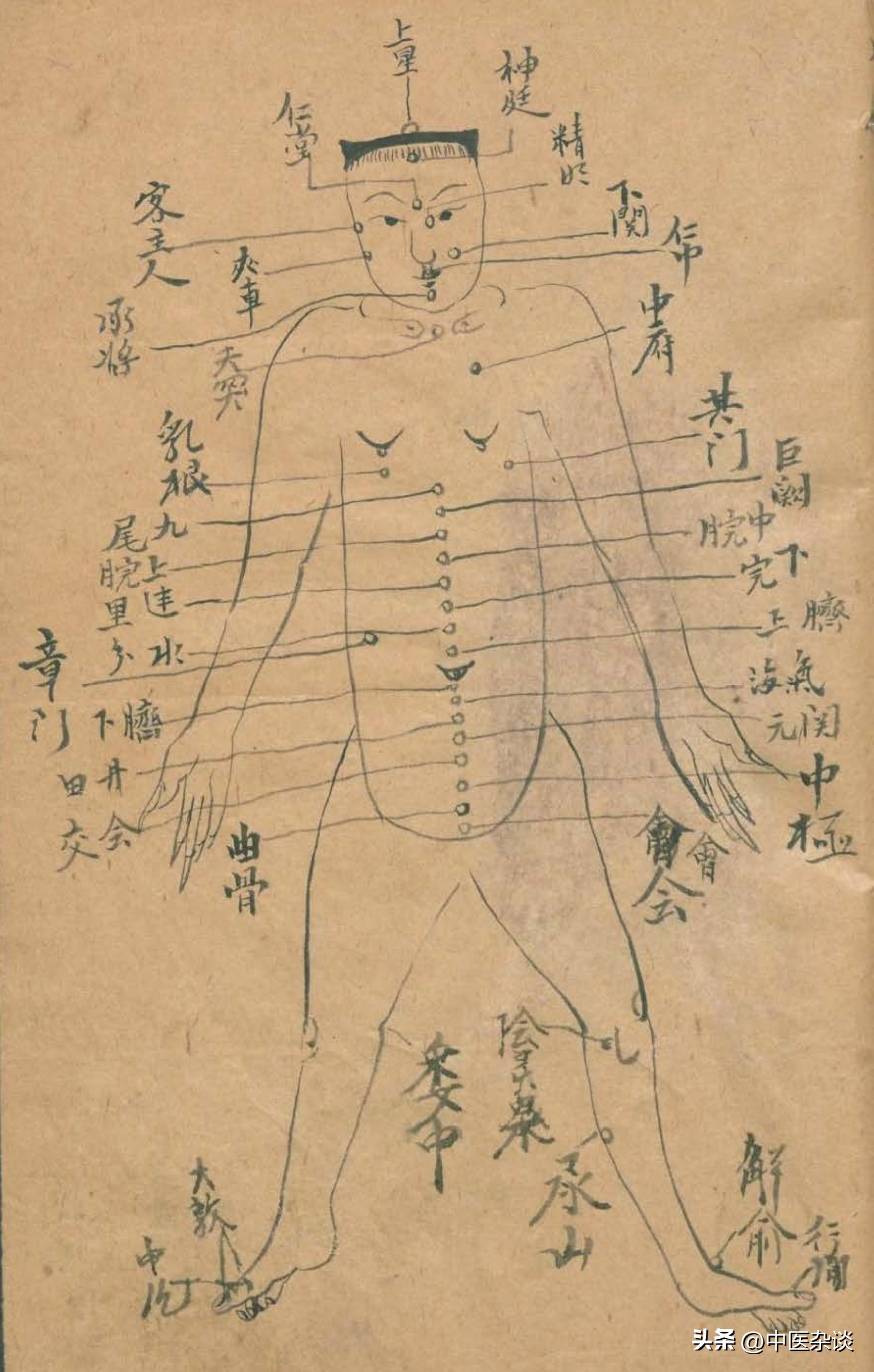 中医针刺放血疗法书,中医放痧口诀大全