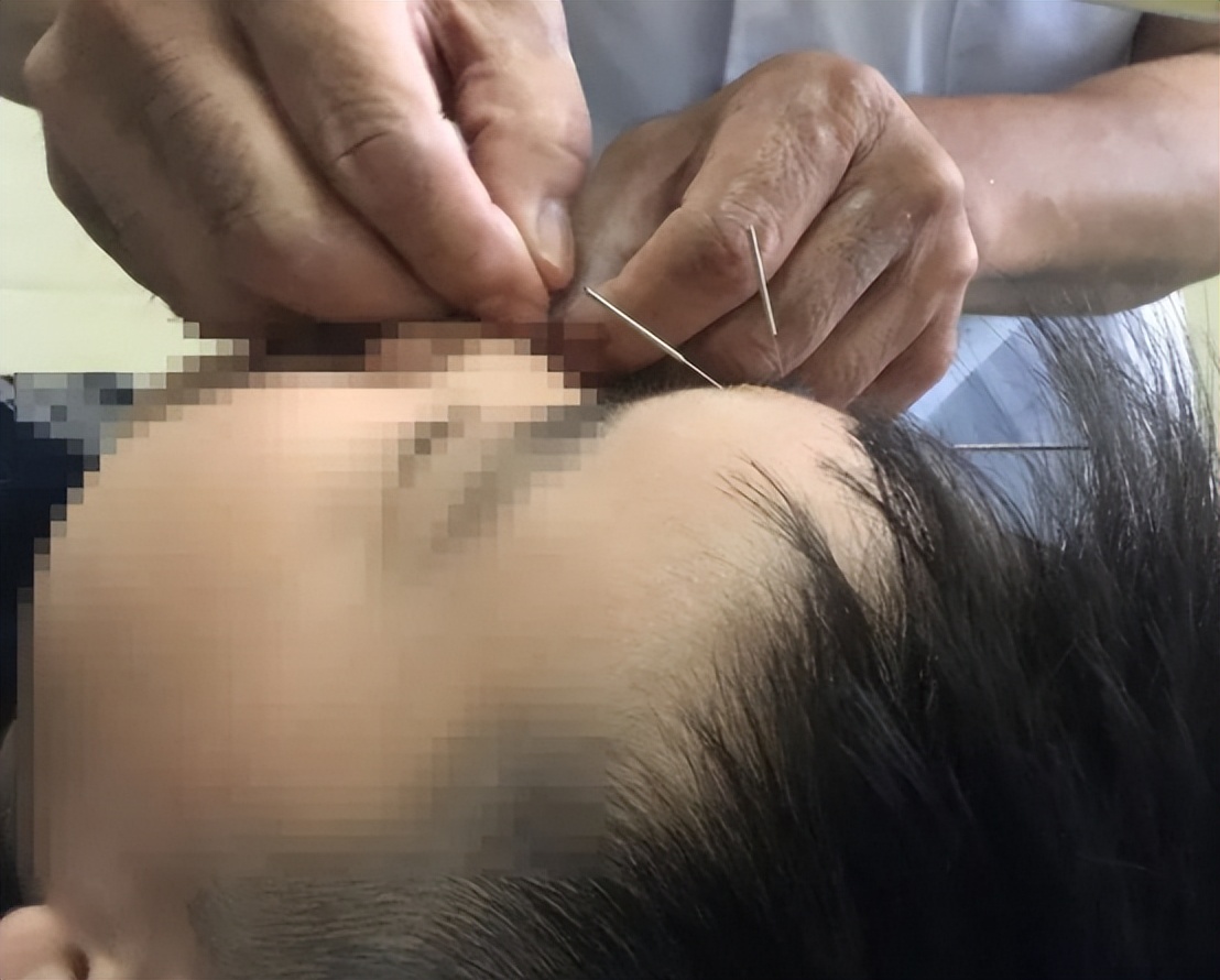 尿频尿急是看中医还是西医好,尿频尿不尽尿少看中医还是西医