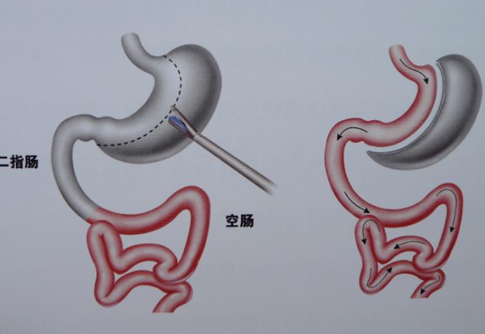 “病态美”：割阴切胃、挑断腿筋，盲目整形，到底怎样才算真的美