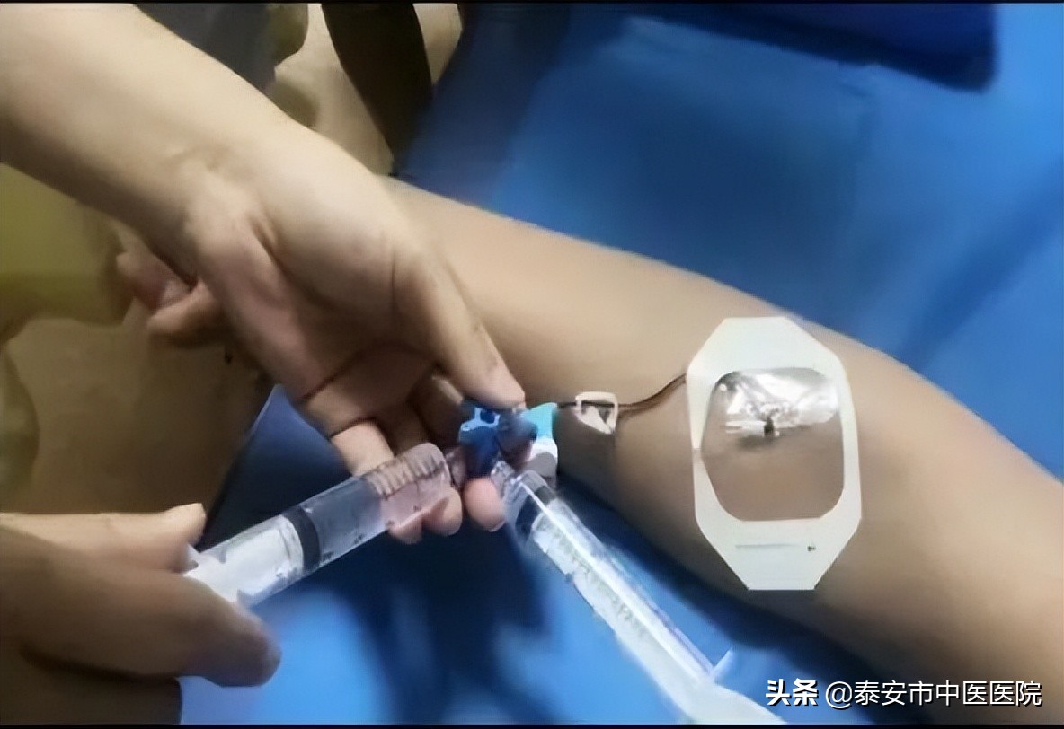 无症状核磁共振诊断脑梗,不明原因头疼需要做脑血管造影吗