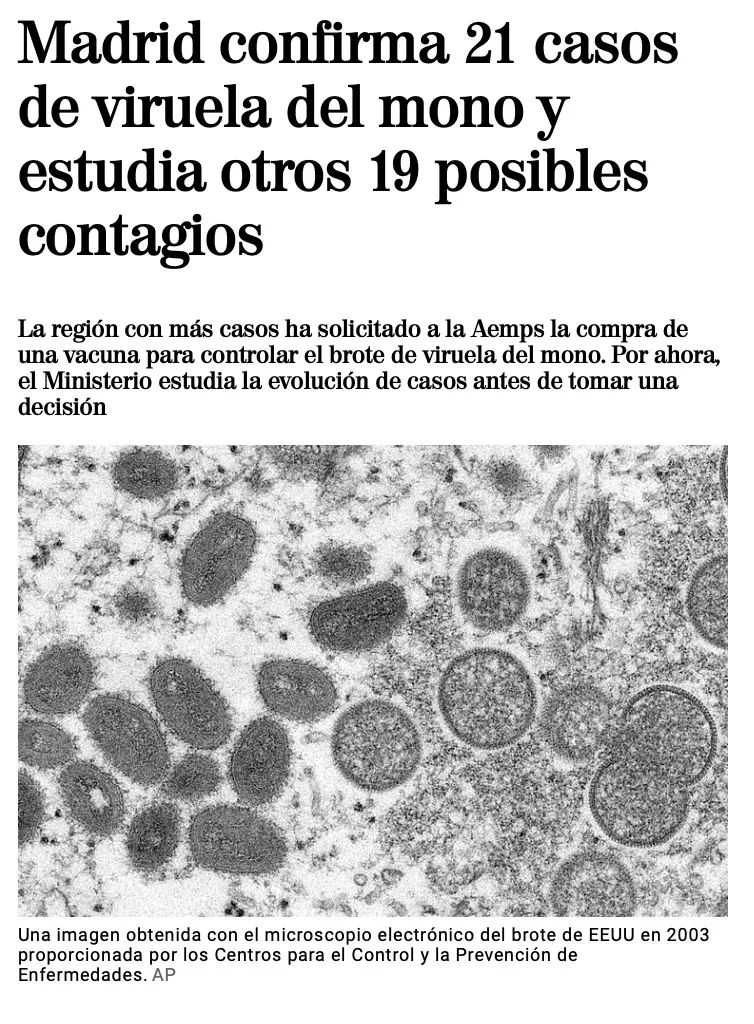 猴痘已在欧洲传播,欧美国家爆发猴痘疫情了吗