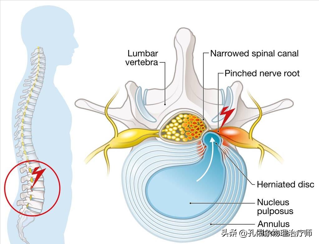 胯骨疼痛警惕四种病,身体有病是什么感觉