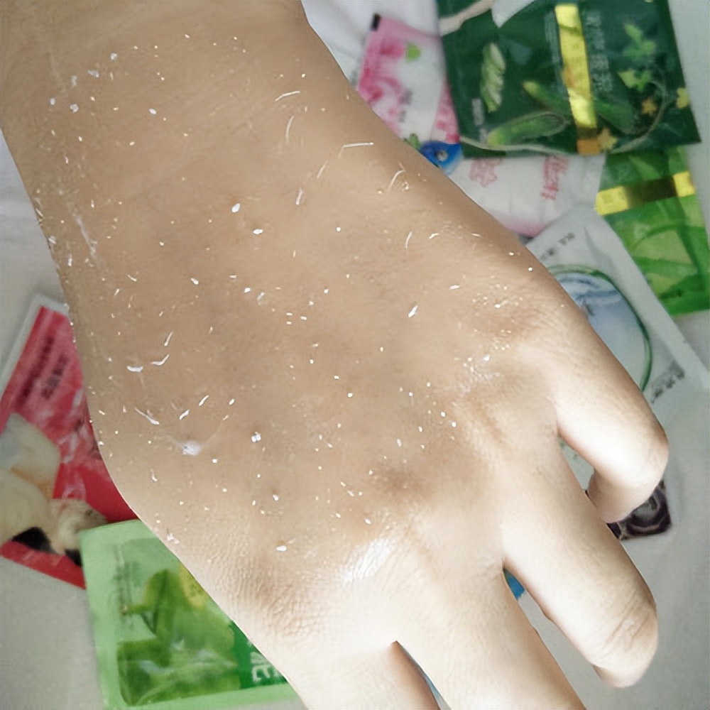 脸上起皮了是怎么回事,脸上起皮是什么原因怎么办