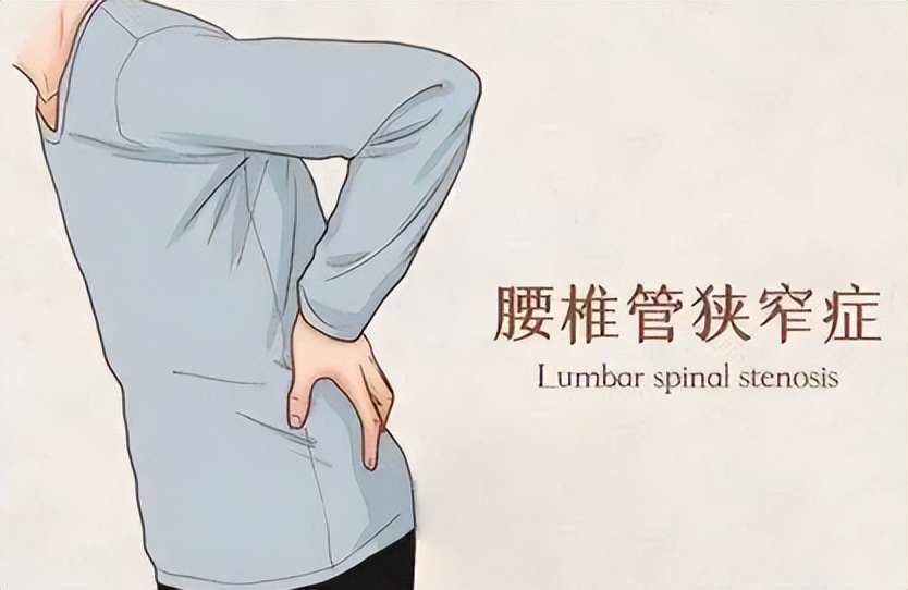 腰痛一直治不好要看神经科吗,经常腰痛要警惕四种原因