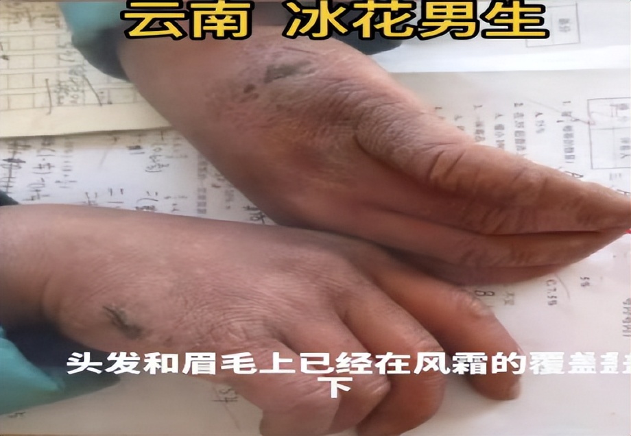 满头冰花上学的男孩,当年冰花男孩近况