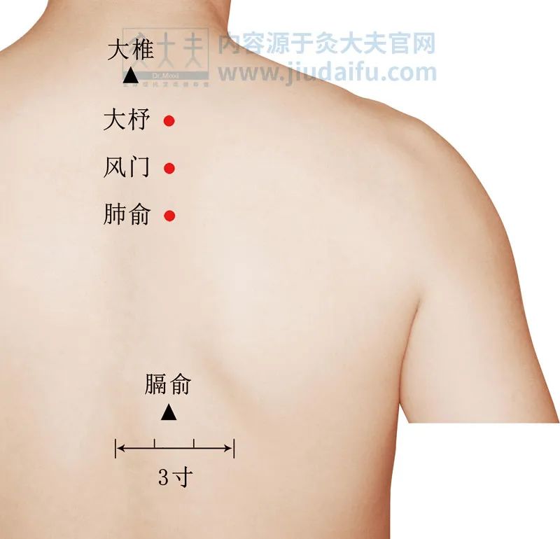 湿疹分为干性湿疹和湿性湿疹吗,湿疹反反复复到底是湿热还是湿寒