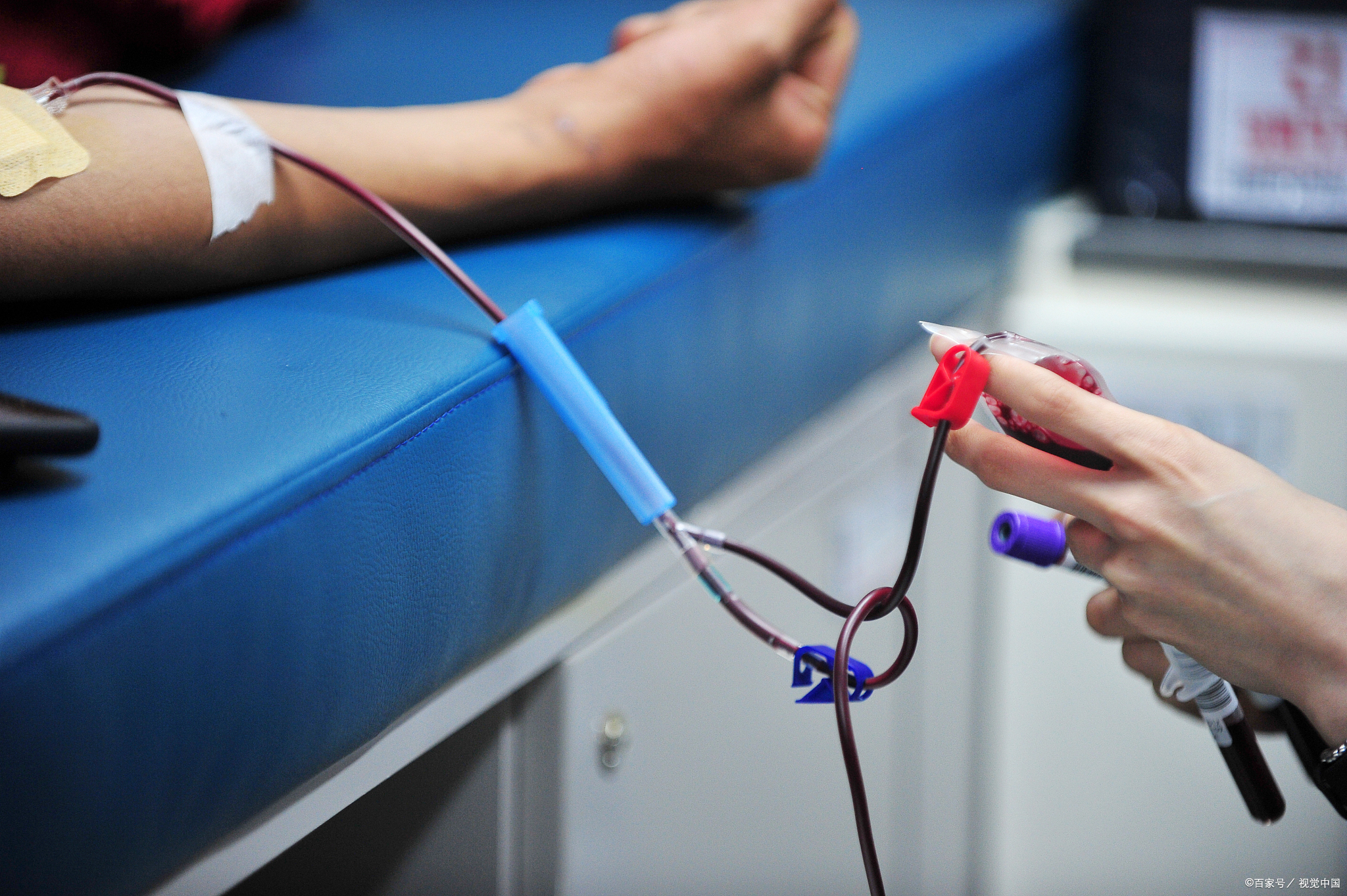 早期艾滋会出现什么皮肤病,不要错把艾滋当皮肤病