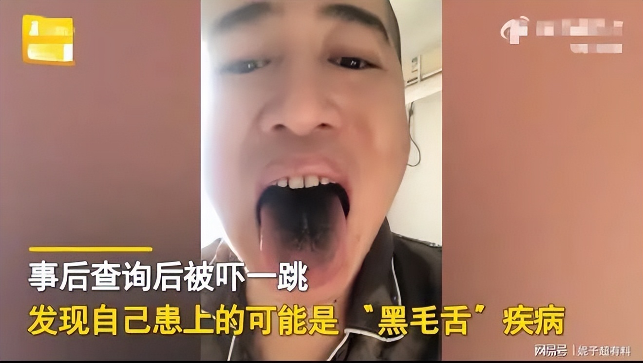 阳了会一夜白头？牙齿舌头全变黑？胃口变大好几倍？网友症状千奇百怪！还有人想主动感染“温和株”？