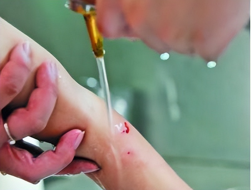 手术后刀疤又出血正常吗,手术后少量出血会影响伤口愈合吗