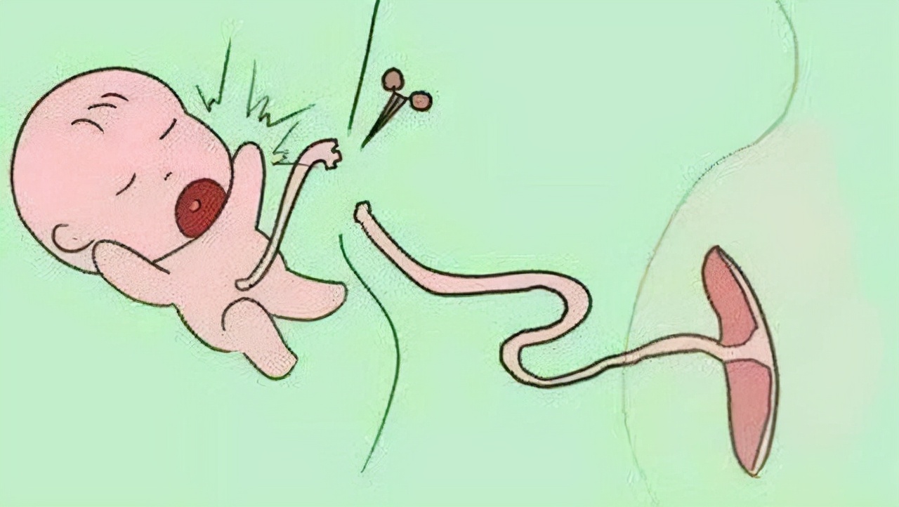 为什么肚脐眼不能抠,为什么说肚脐眼有泥不能抠