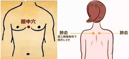 感冒之后咳嗽总不好喝什么,感冒后咳嗽不好需要服用抗生素吗
