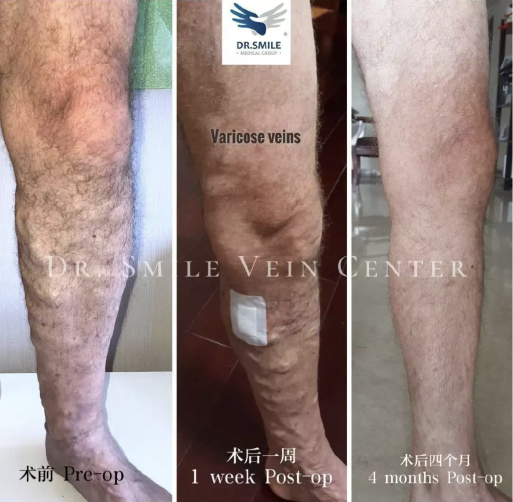 张强医生集团直播平台,张强医生集团西安