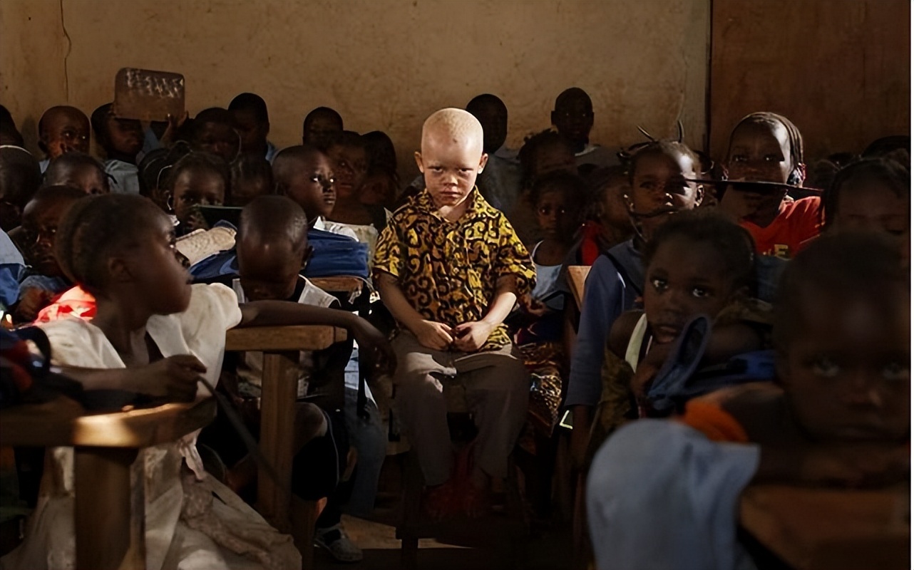 非洲最特殊的人群：血液堪比黄金，遗骸卖上百万，却无法健康成长