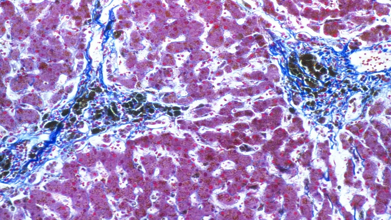 谷草转氨酶和谷丙转氨酶谁更重要,谷丙转氨酶与谷草转氨酶哪个要紧