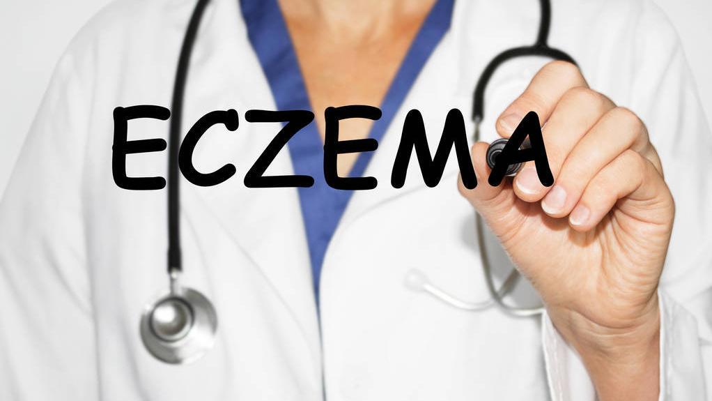 湿疹治愈期特别痒用什么药,湿疹很痒怎么处理用什么药