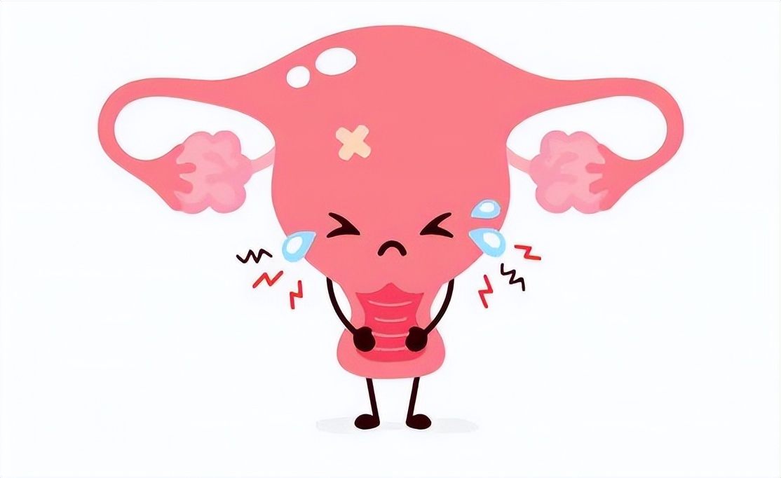 神秘的宫腔积液，你从哪里来？