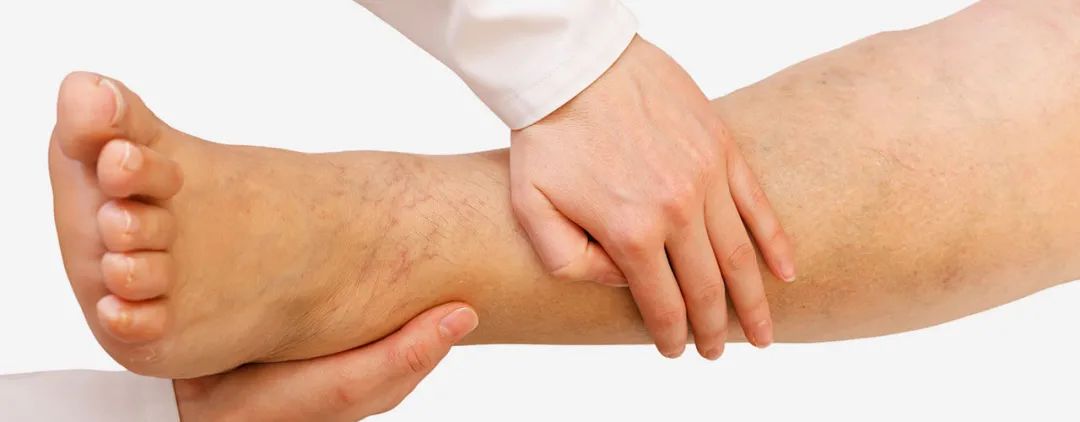 足踝术后怎么消肿,足跟骨术后肿胀如何消除