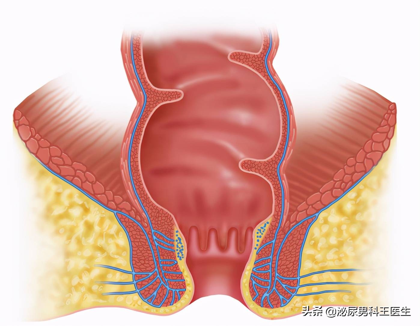 肛门潮湿发痒是什么病,肛门潮湿瘙痒是什么病怎样治愈
