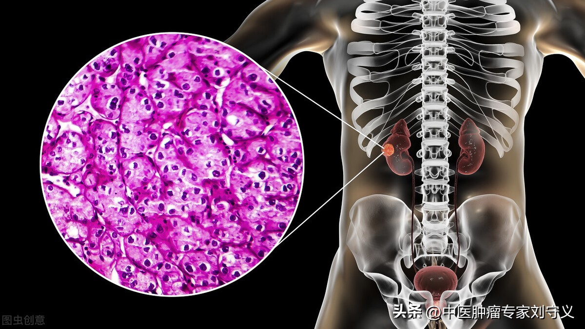 肉苁蓉治疗癌症,和肉苁蓉同效的中药