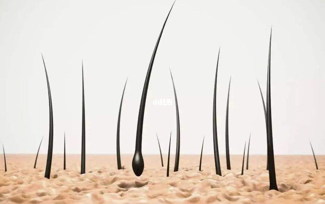 为什么有人“下面”没有毛?女性*处私**毛发的4个作用,别羞于了解