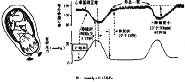孕妈妈需要经历什么,从怀孕到生需要做多少次产检