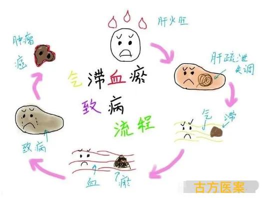 朱半仙遗留的一个千金特效方，消散各种结节，男女都适用