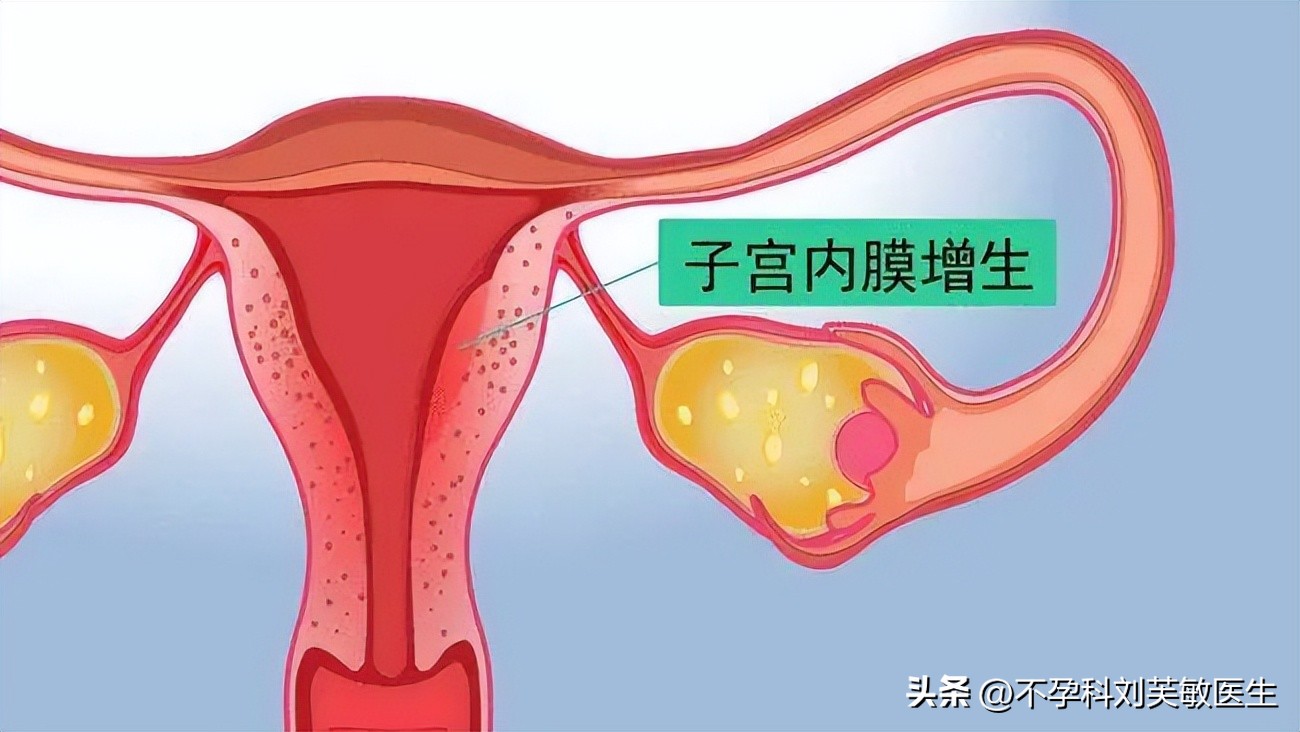 多囊卵巢不治疗的后果有哪些呢,多囊卵巢不调理会怎样