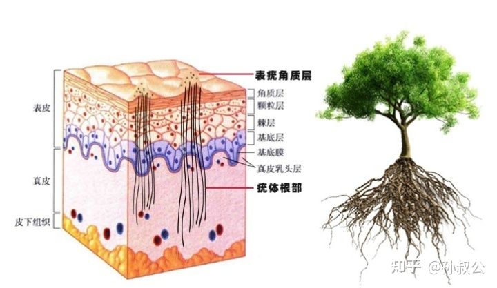 瘊子形成原因及治疗,寻常疣俗称瘊子是怎么形成的